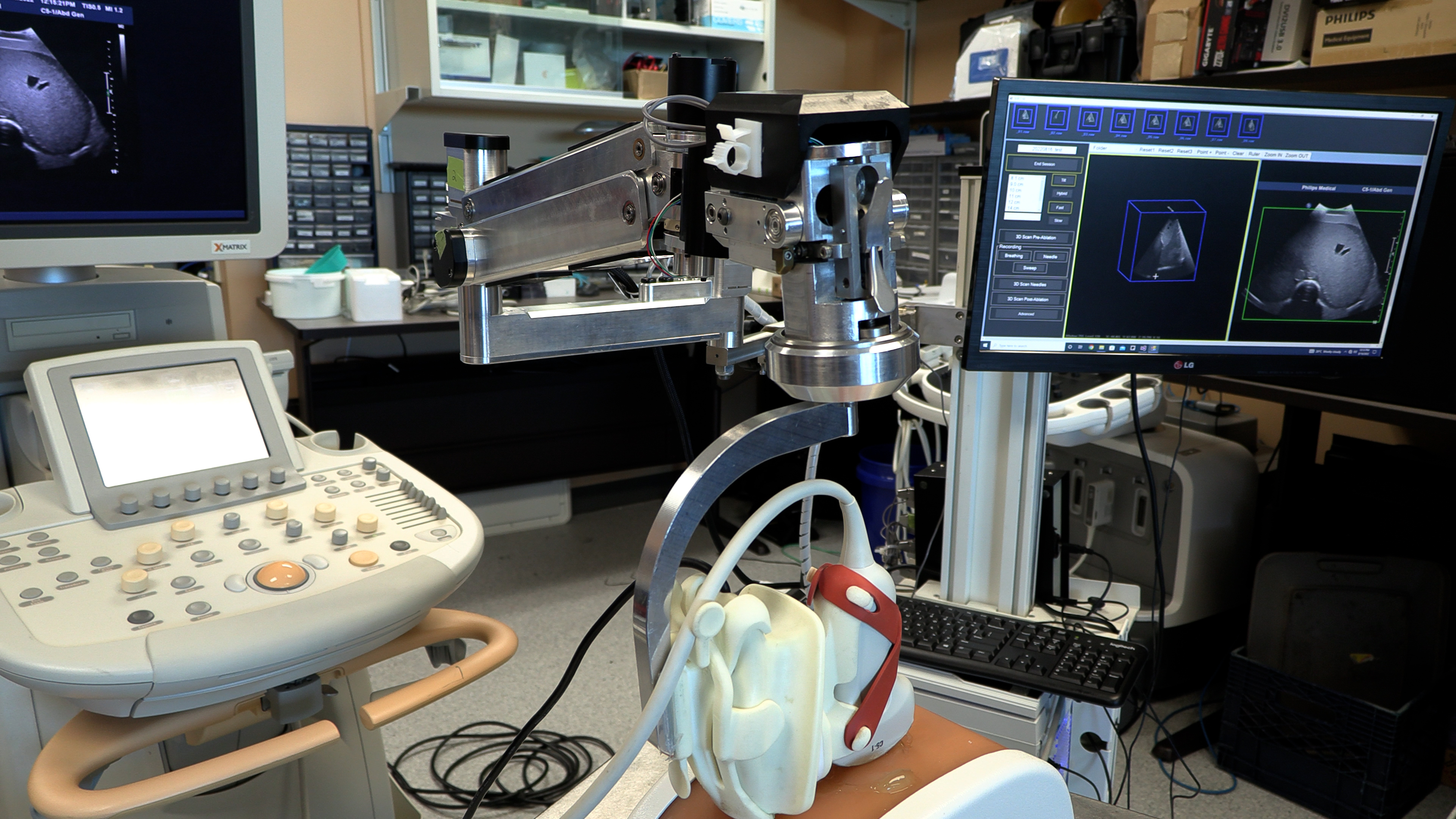 The 3D images produced by a robotic arm operating an ultrasound probe are seen at the Robarts Research Institute in London, Ont.