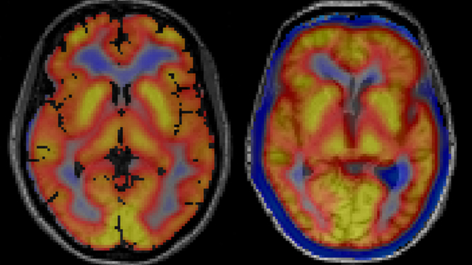 Brain images from imaging machine