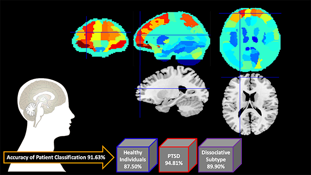 Brain scans from Lawson research study