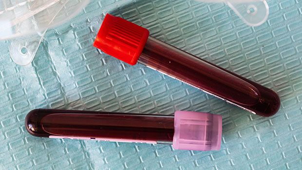 Vials of blood for medical testing