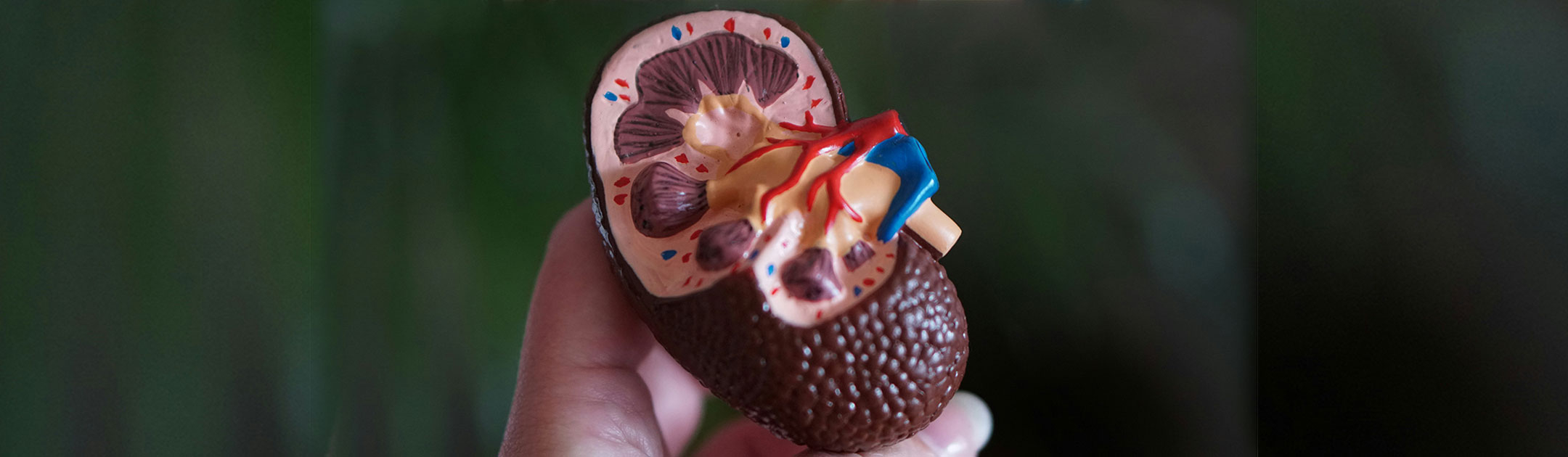 A model of a kidney