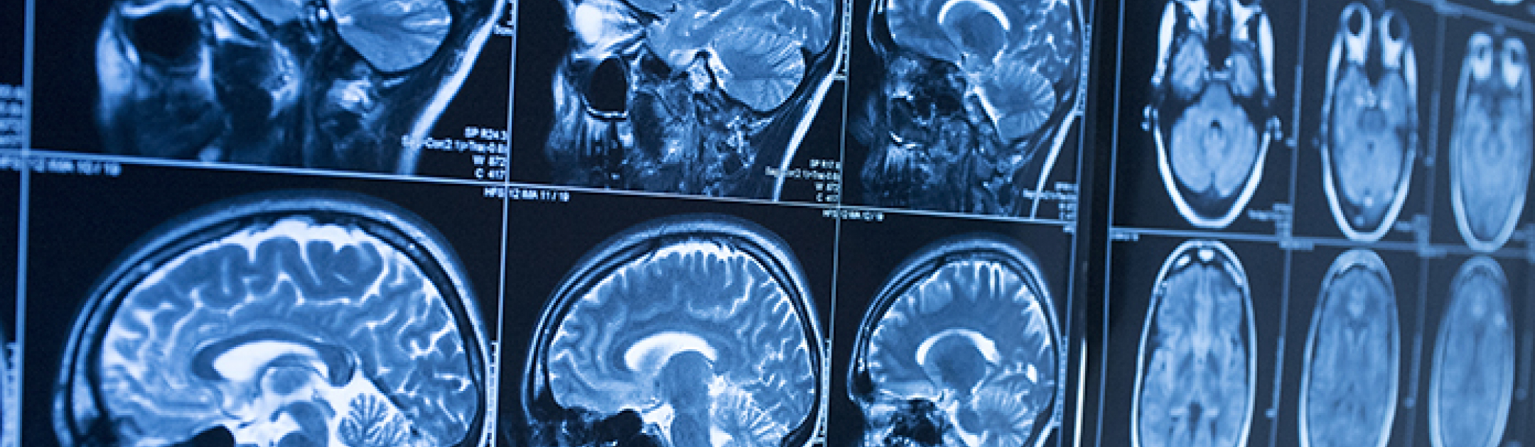 Photo of brain scans